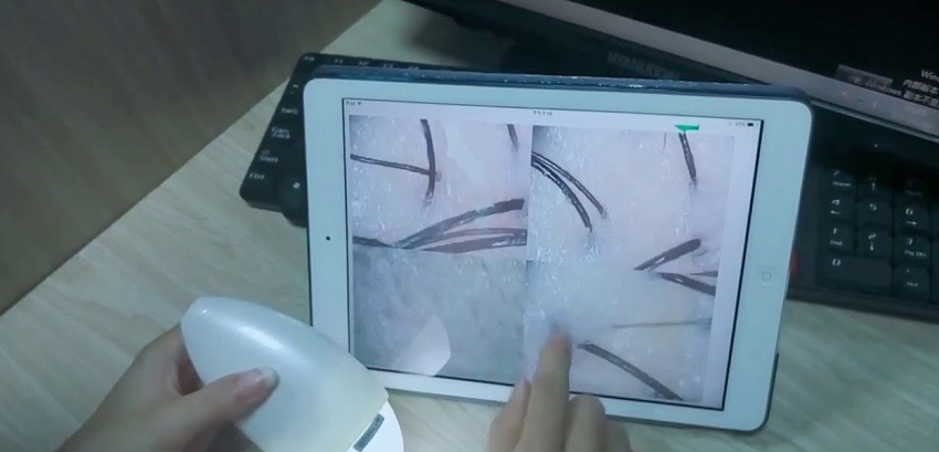 máy soi da cắt lớp